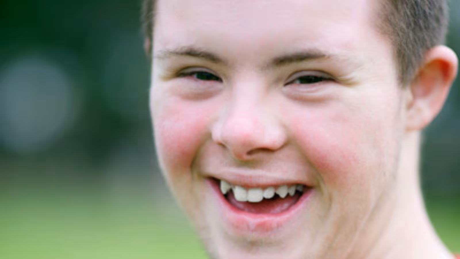 Untitleddesign5.png Up-close image of the smiling face of a teenager with Down syndrome.