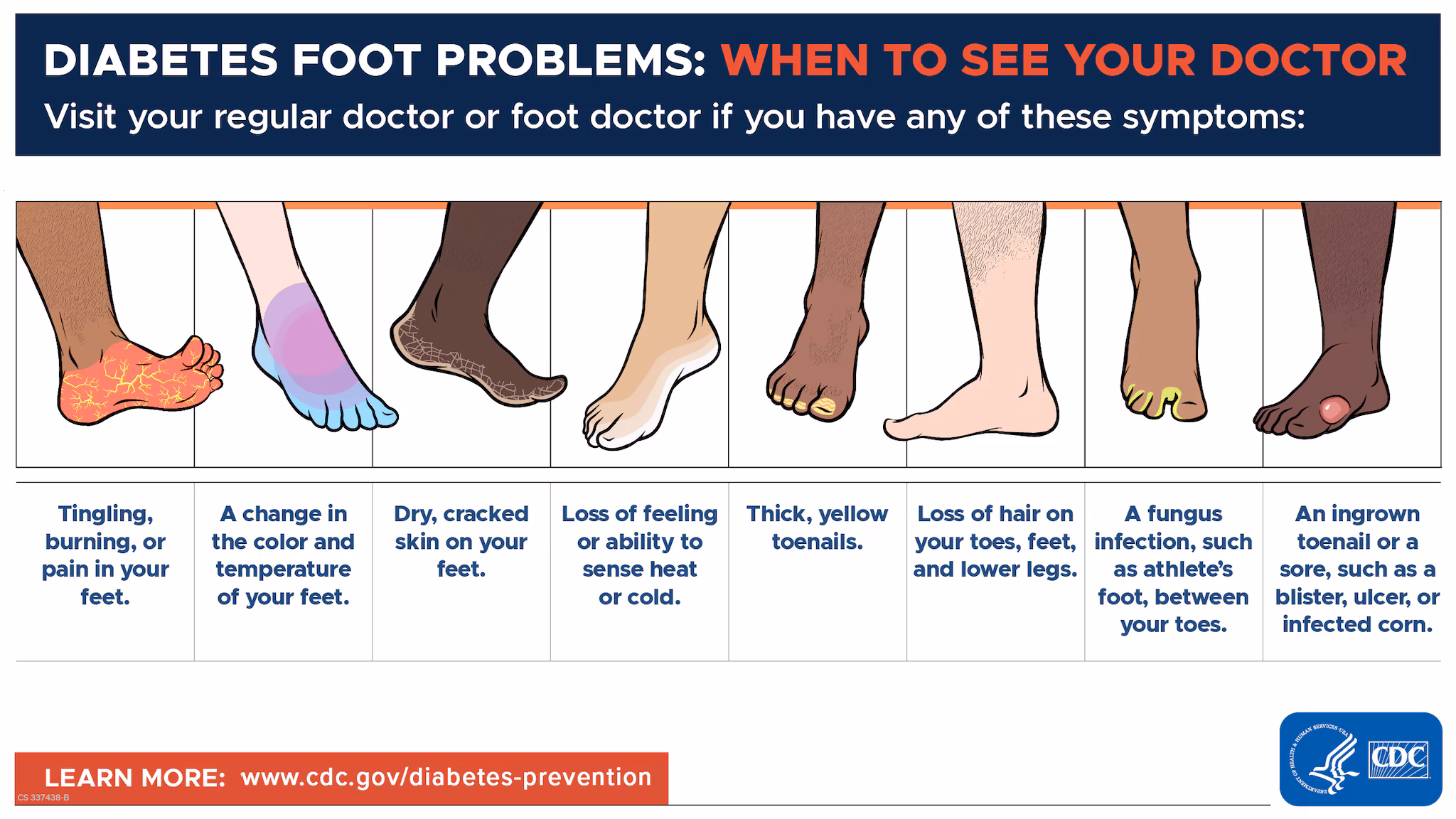 Diabetes Foot Problems - Visit your regular doctor or foot doctor if you have any of these symptoms.
