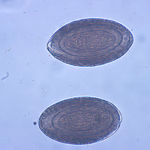 M_hirudinaceous_egg1.jpg
