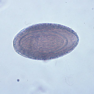 M_hirudinaceous_egg2.jpg