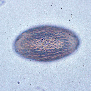 M_hirudinaceous_egg3.jpg