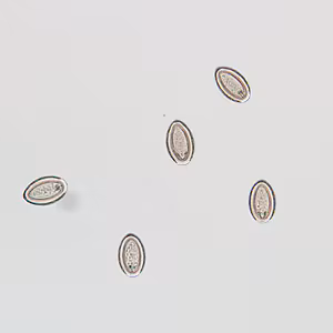 M_moniliformis_egg_HB1.jpg