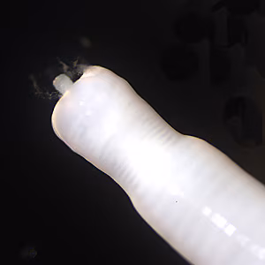 M_moniliformis_anterior_HB1.jpg
