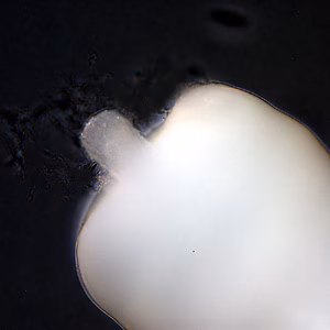 M_moniliformis_anterior_HB2.jpg