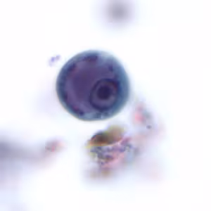 Ehisto_cyst_tric.jpg