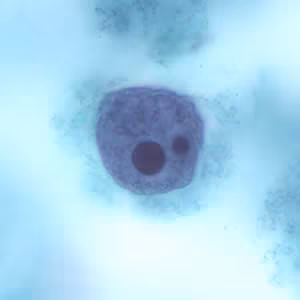 Ehisto_troph_tric6.jpg