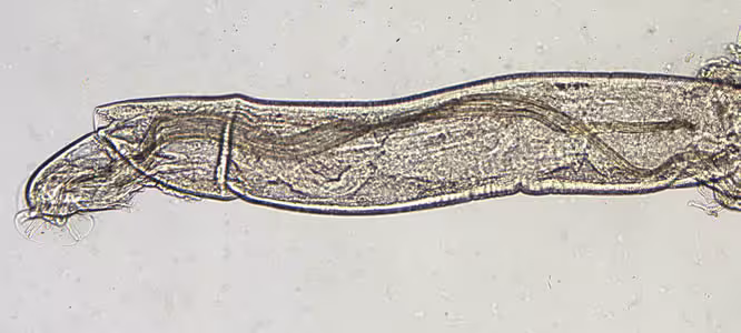 Angio_10x_spicules_web.jpg