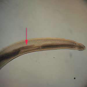 Pseudoterranova2_anterior.jpg
