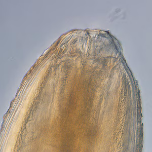 Pseudoterranova_anterior_200x.jpg