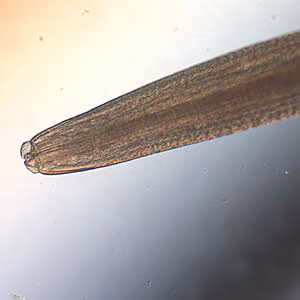 Pseudoterranova_anterior_40x.jpg