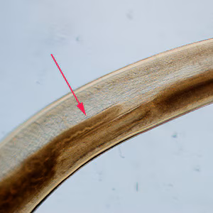 Pseudoterranova_cecum_200x.jpg