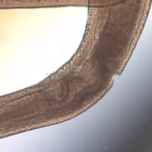 Pseudoterranova_mid_40x.jpg