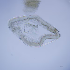 Anisakis_cross_section_HB1.jpg