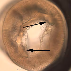 Pseudocontra_crosssection.jpg