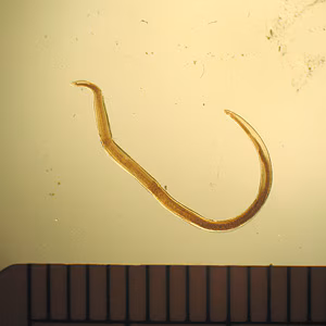 Pseudoterranova_whole1.jpg