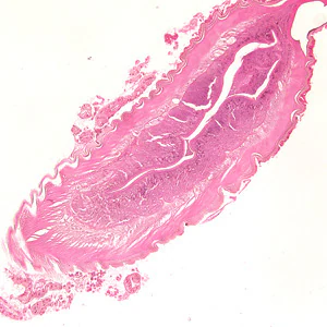 anisakid_tissue_100x_BAM.jpg
