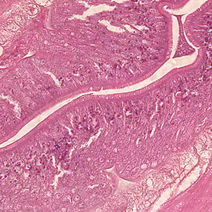 anisakid_tissue_400x_BAM.jpg