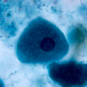 epithelial_cell1.jpg