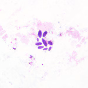 yeast_tissue.jpg