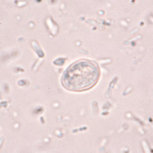 artifact-chilo1.jpg