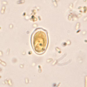 artifact-giardia1.jpg