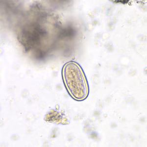 morel_spore_HB1.jpg