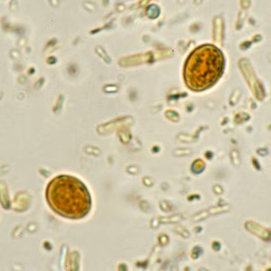 yeast_wtmt1.jpg