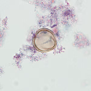 pollen_HB2.jpg