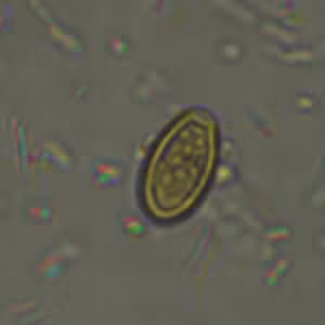 pollen_WA3.jpg