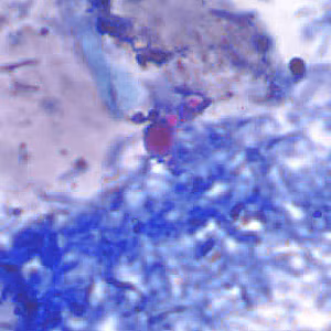 acid_fast_artifact_AZ1.jpg