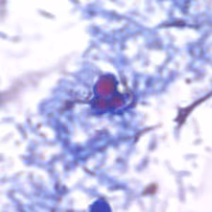 acid_fast_artifact_AZ2.jpg