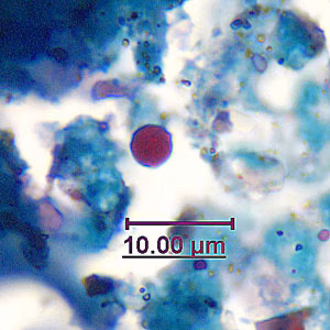 acid_fast_artifact_GA1.jpg