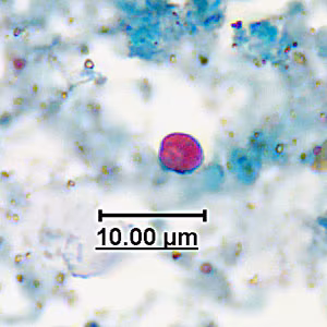 acid_fast_artifact_GA2.jpg