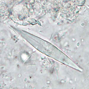 CL_crystals_HB1.jpg