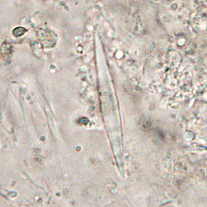 CL_crystals_HB2.jpg