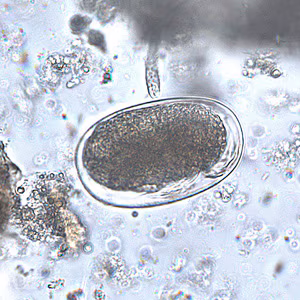 mite_egg1.jpg