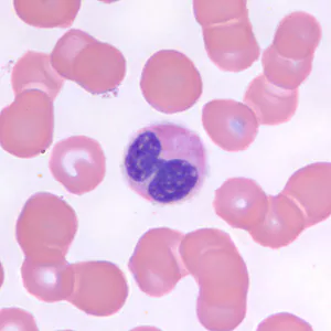 lymphoctyte_BAM.jpg
