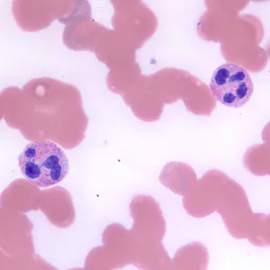 neutrophils_BAM1.jpg