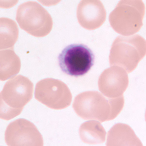 small_lymphocyte_BAM1.jpg