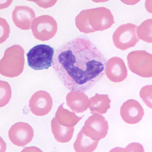 small_lymphocyte_neutrophil_BAM1.jpg