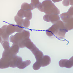 Helicosporum_HB.jpg
