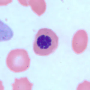 nucleated_rbc3.jpg