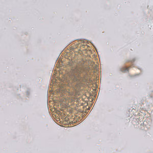 A_lumbricoides_infert_Leiden_A.jpg