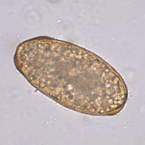 A_lumbricoides_infert_Leiden_B.jpg