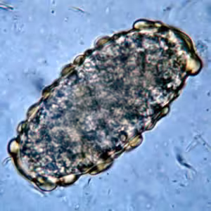 Ascaris_egg_unfert.jpg