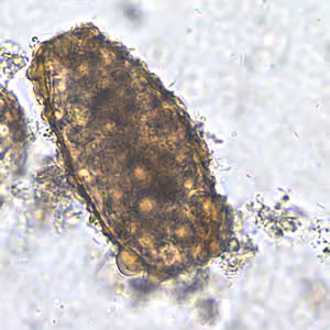 Ascaris_egg_unfert2_200x.jpg