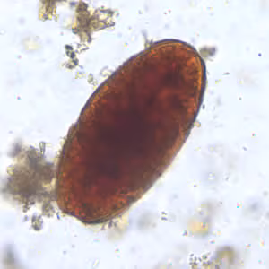 Ascaris_egg_unfert_decort_200x.jpg