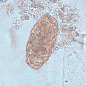 Ascaris_lumbrcoides_infertile_BAM1.jpg