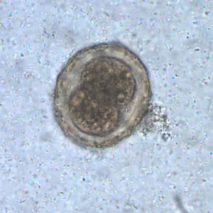 Ascaris_egg_fert2_embryo.jpg