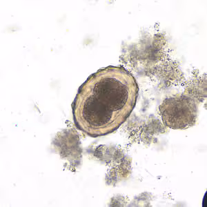 Ascaris_egg_fert3_embryo_200x.jpg